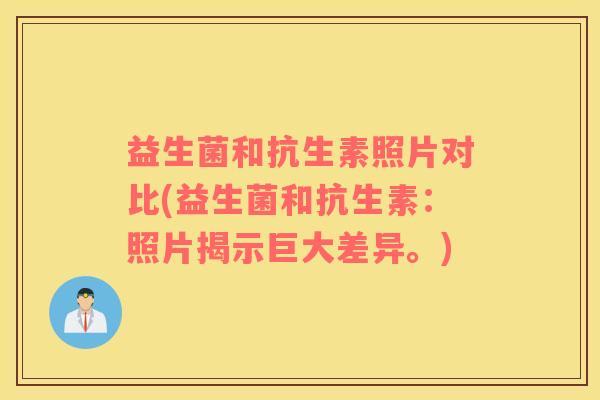 益生菌和抗生素照片对比(益生菌和抗生素：照片揭示巨大差异。)